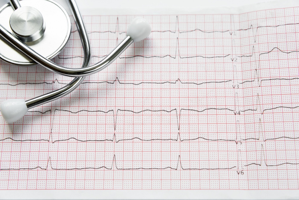 Holter cardiaco in farmacia? Lo trovi da noi!